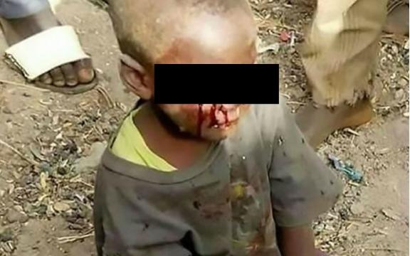 Uma madrasta arrancou os olhos de seu enteado, um menino de quatro anos. O ato cruel teria sido o castigo, por a criança ter molhado a cama na noite anterior. O incidente chocante aconteceu na província de Masvingo