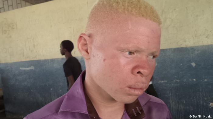O Governo reiterou o compromisso de fortalecer medidas de combate aos raptos, assassinatos e tráfico de órgãos ou pessoas com albinismo