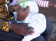 Bebê de 7 meses nasceu sem ânus no município da Matola