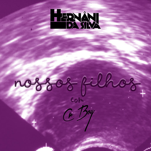 Hernâni – Nossos Filhos (feat. Cr Boy) [2020] DOWNLOAD MP3